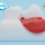 Toothpaste is Damaging Gums