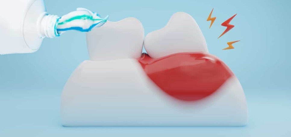 Toothpaste is Damaging Gums
