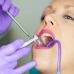 Biofilm Remover for Teeth and Gums