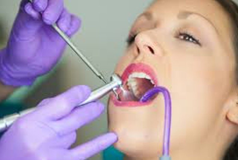 Biofilm Remover for Teeth and Gums