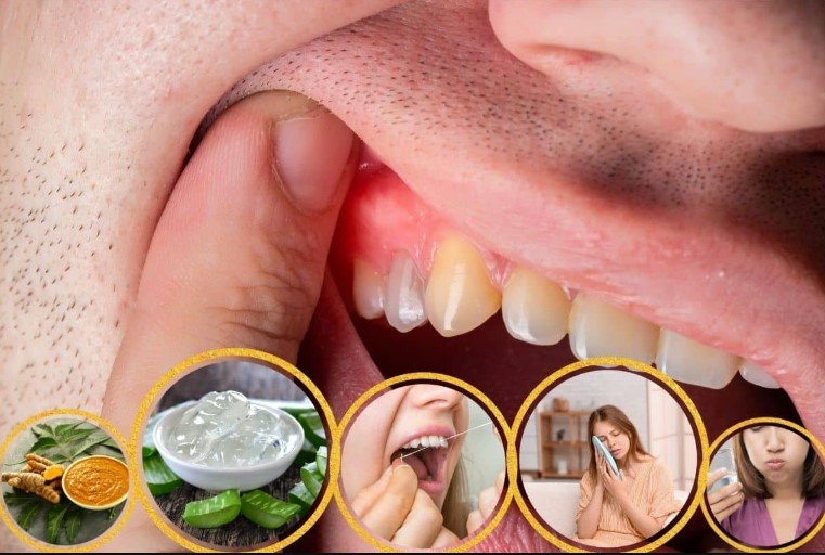 detoxifying the mouth for healthier gums