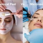 Microneedling vs. Chemical Peels in Lake Mary